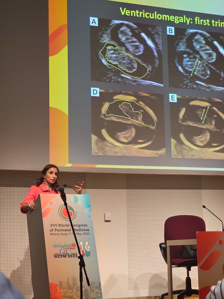 ProfAsmaKhalil's tweet photo. What a successful World Congress of perinatal Medicine in Milan! More than 1200 delegates, great faculty and sessions. Congratulations! Thank you for inviting me to talk on twins, congenital CMV infection and first trimester anomalies. https://t.co/ZUxnFdCHgj