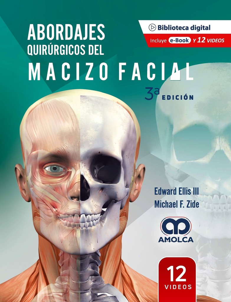 AxonLibreria's tweet photo. Os informamos de la nueva edición del libro ABORDAJES QUIRÚRGICOS DEL MACIZO FACIAL. Este libro describe: el abordaje transconjuntival de la órbita medial, el abordaje subtarsal a la órbita interna, el abordaje de Weber-Fergusson al tercio medio facial, el degloving facial y… https://t.co/HxgkSa3uHm