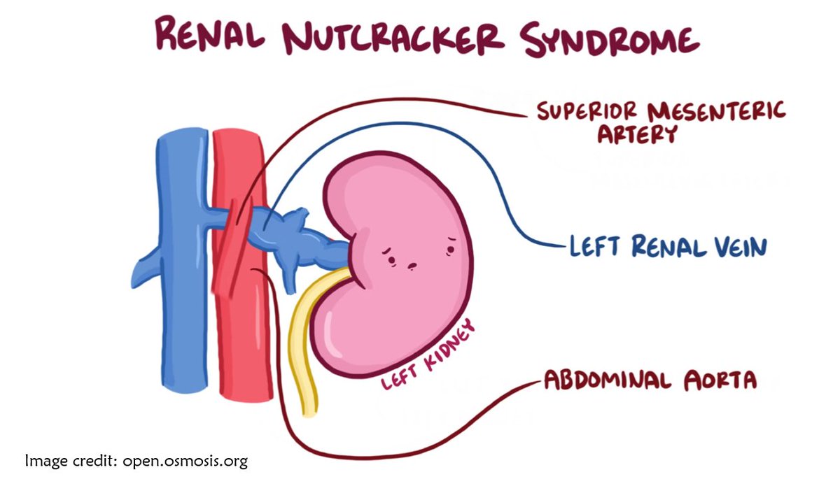 NephroPOCUS tweet media