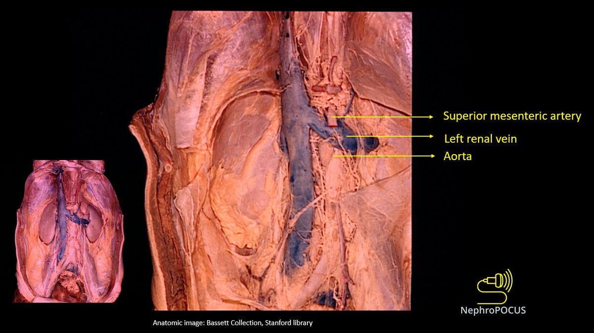 NephroPOCUS tweet media