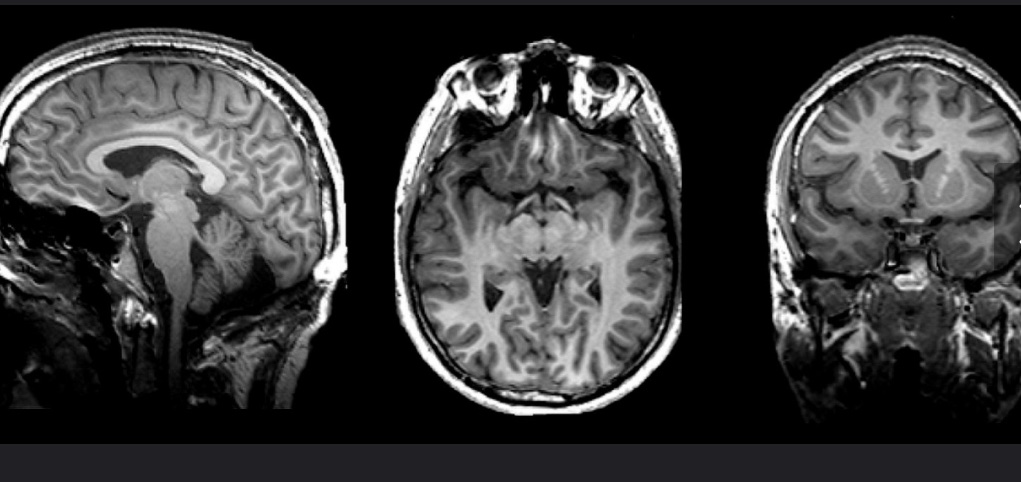 New Snippet!

Visualising 'White Lies' - A new approach for catching liars on the spot.

Author: Despoina Allagioti

Link- the-gist.org/2023/05/visual…