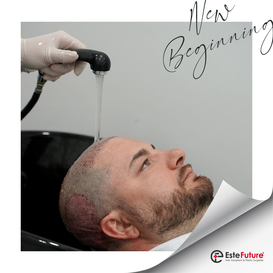 'Hair transplantation is the first step to a renewed self!' #estefuture #hairtransplant #clinic #hairtransplantistanbul