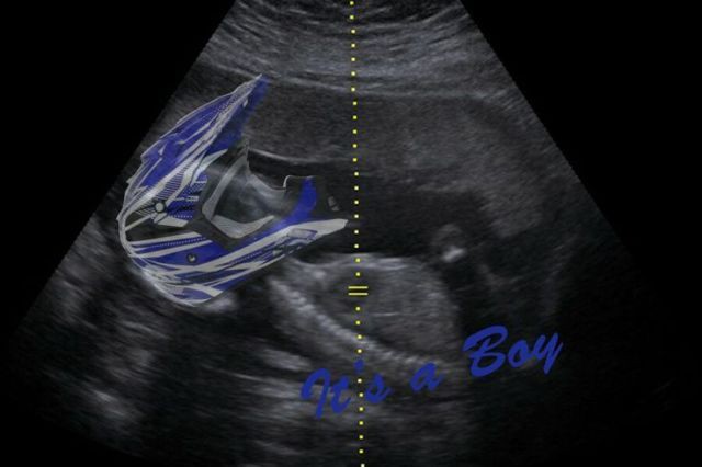 lo que vieron mis padres en el ultrasonido cuando me andaban esperando. confirma <a href="/ABRASIV0/">𝕷eo (au).</a>