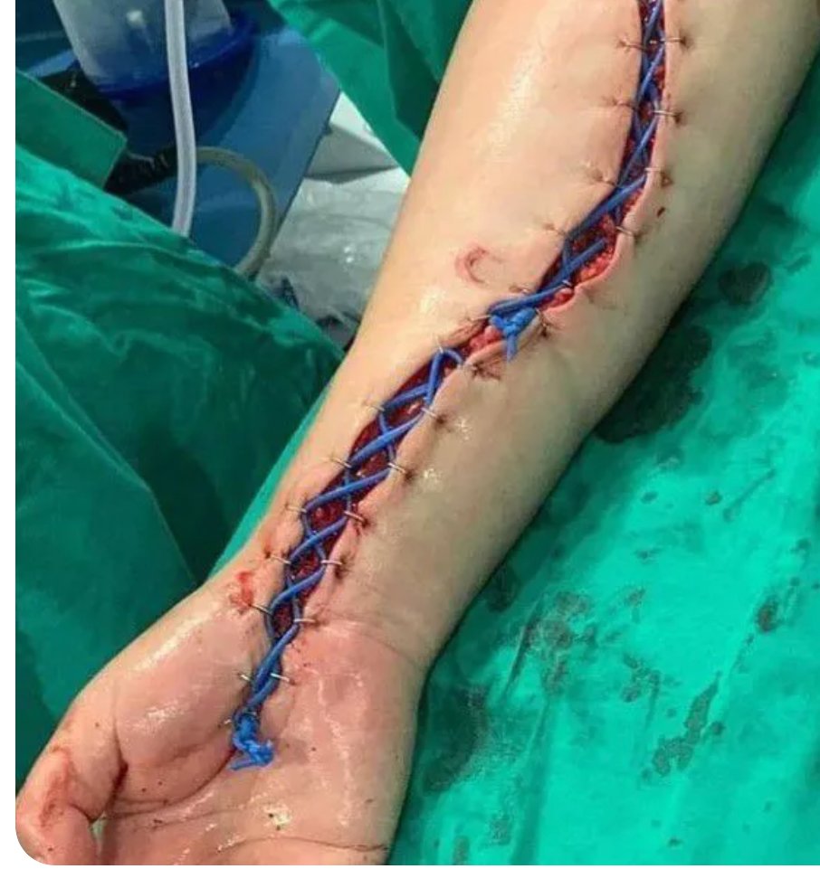 Oren Gottfried, MD tweet media