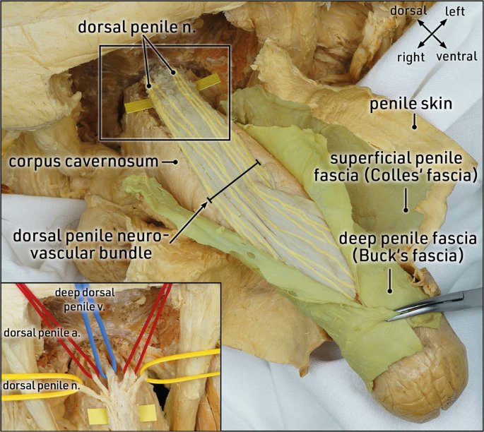 yoursexmedjour's tweet photo. Anatomic considerations of inflatable #PenileProsthetics: lessons gleaned from surgical body donor workshops👉https://t.co/TxLSKRZx9i

@OsmonovDr @SKWilson10 @ragheba @SexHealthMD @MayoUrology @rigiconurology @bsc_urology @ED_solutions_CP @SocietyGURS https://t.co/CxD72E6SlP