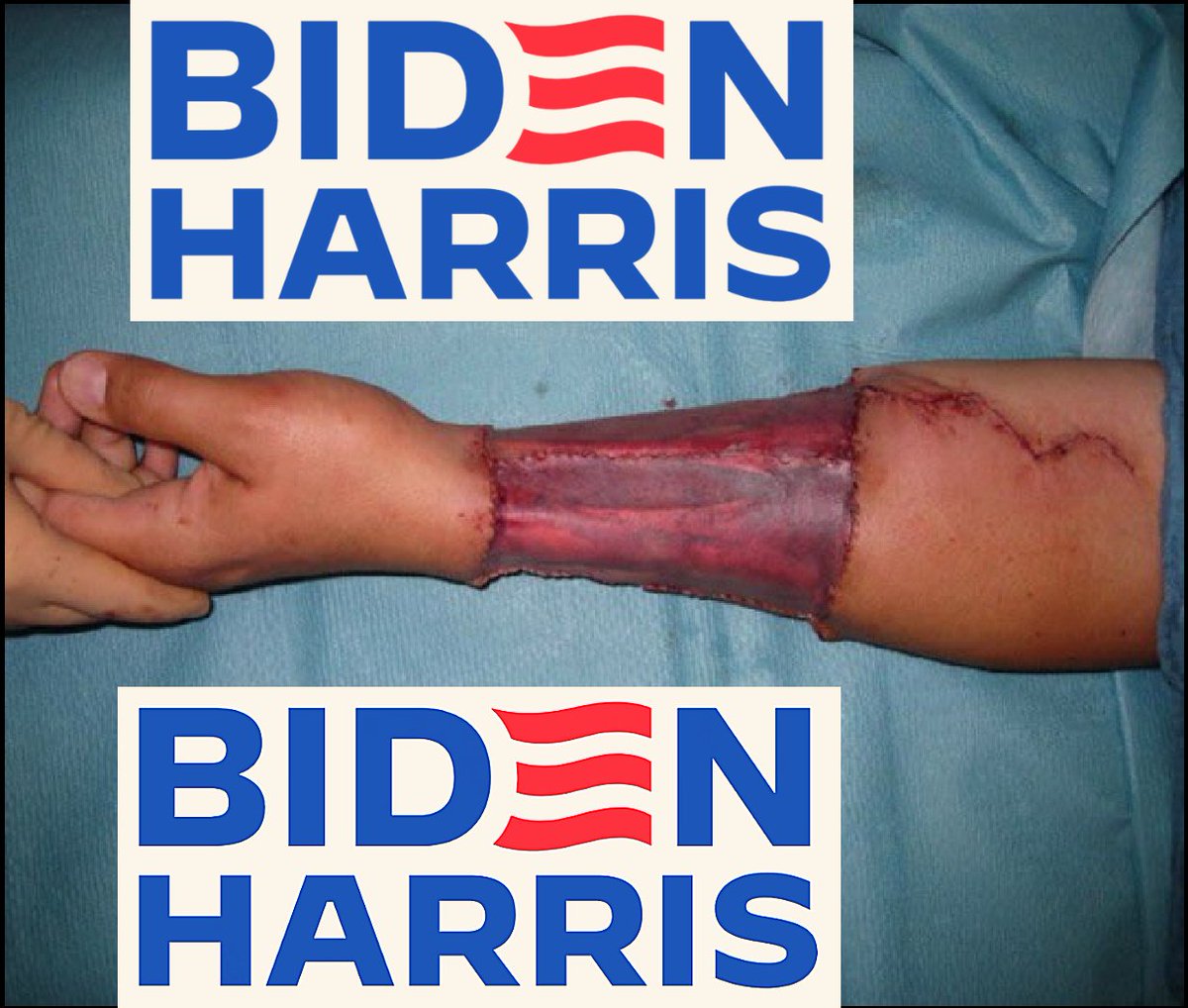 SeekingTruth4us's tweet photo. @DrLoupis 🤔If this was just biological rather than ideological why is it so much more prevalent among @TheDemocrats #BidenHarris2024 😷
https://t.co/TX8CXPrJDT https://t.co/gjwiEXXBRb