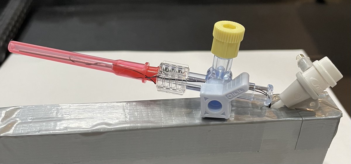 HadyLichaaMD's tweet photo. #CathLabHack:
Sterile maintenance of #PercloseSutures around #IndwellingLargeBoreSheath w constant pull on nonlocking suture to⬇️#Oozing
#StopcockBluntNeedleCombo technique: https://t.co/FSy70HHInb
#CutSheathSideport technique
https://t.co/xCyfgTaInb
@KardiologieHH @PCRonline https://t.co/oWB0zLHWDS