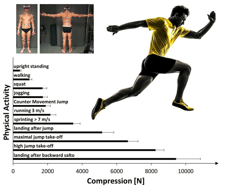 PhysioMeScience's tweet image. Just published 🔥

The mechanical loading of the spine in physical activities
🏋️🏋️‍♀️⛹️🤸‍♂️🏌️

pubmed.ncbi.nlm.nih.gov/37166549/