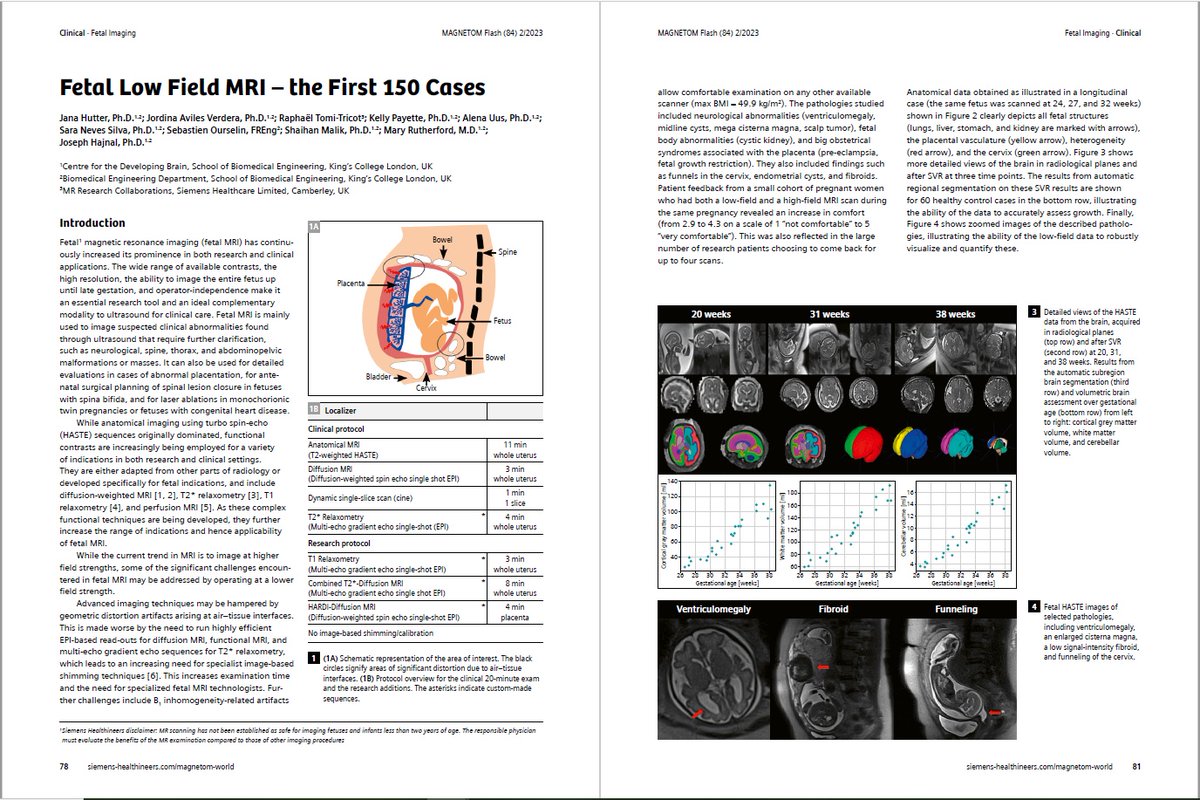 Fetal Low Field #MRI - the First 150 Cases by @janahutter and colleagues (@KingsImaging, London, UK). Learn more about #fetalMRI at 0.55T …ng.webassets.siemens-healthineers.com/170b70a2298ce6…
#magnetomworld