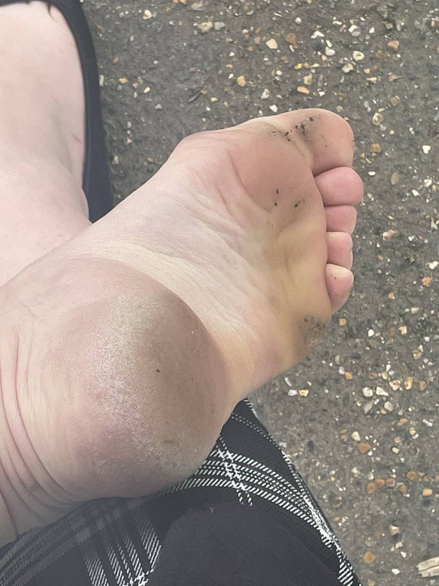 BunionBabeee's tweet photo. Ohhh my poor feet! Wish someone would rub them 💦😈🍆🤤 #feet #feet_pic #feetcontent #feetfethish #feet_lover #feetfetiche #feetpic #feetfinder #dirty #rub #adult #bunions #f #cum #dommymommy #findom https://t.co/Q15Syy65Vx