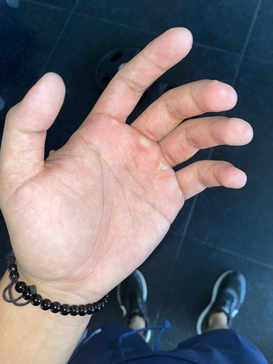 Rasakan perih nya kulit terkelupas itu, nikmati rasanya.