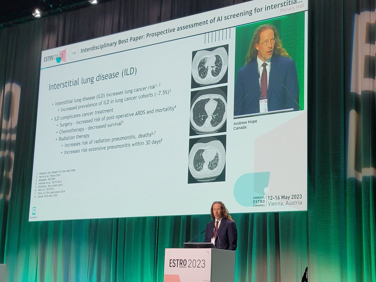 Andrew Hope, one of the winners of best paper at #ESTRO2023, presenting on AI screening for interstitial lung disease.