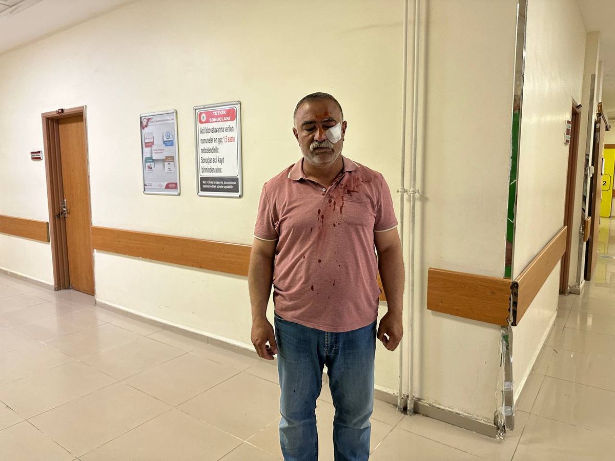 Mardin'de AKP’li aday Faruk Kılıç’ın akrabaları toplu oy kullanımını kayıt altına almak isteyen Yeşil Sol Parti’nin müşahitlerine saldırdı.