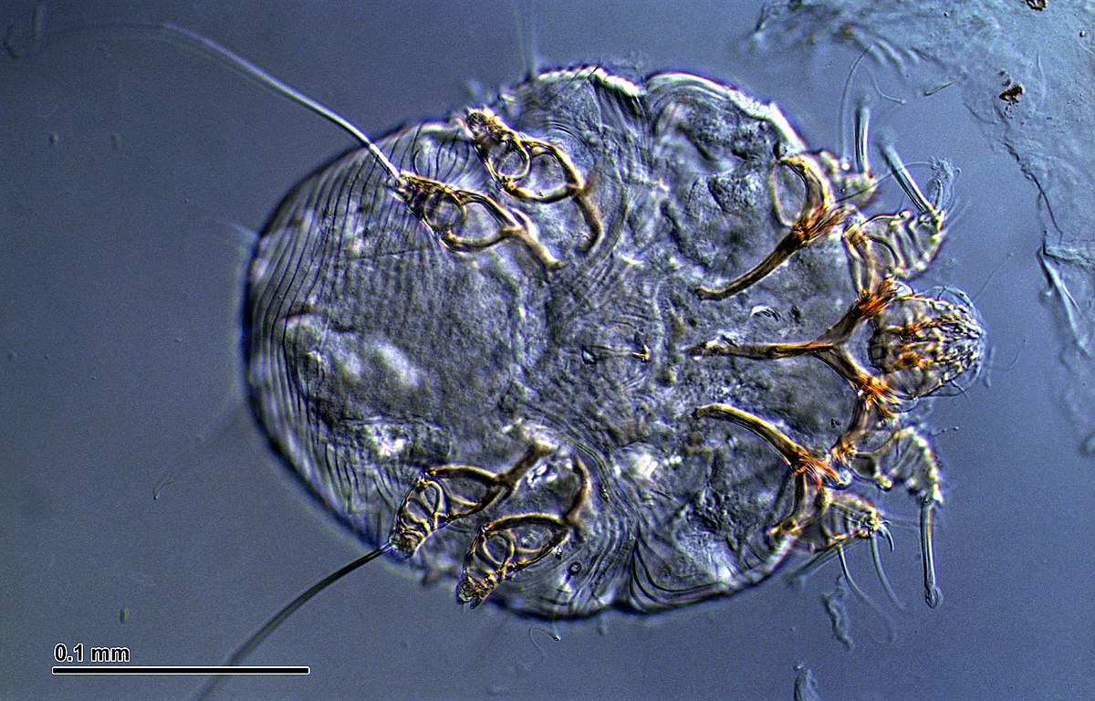ParasiteJournal's tweet photo. [Highly cited 2016 open access paper]

The effects of climate factors on scabies. A 14-year population-based study in Taiwan

https://t.co/63YnHPPEsl https://t.co/pv5fPJRbiT