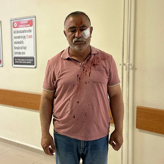cumhuriyetgzt1's tweet photo. AKP'lilerin toplu oy kullanımını engelledi, az daha canından oluyordu

Mardin’de AKP Milletvekili adayı Faruk Kılıç ve akrabalarının toplu oy kullanımını kayıt altına almak isteyen Yeşil Sol Parti müşahitine saldırıldı

Yaralanan müşahit hastanede tedavi edildi https://t.co/S2jYt6pjJ4