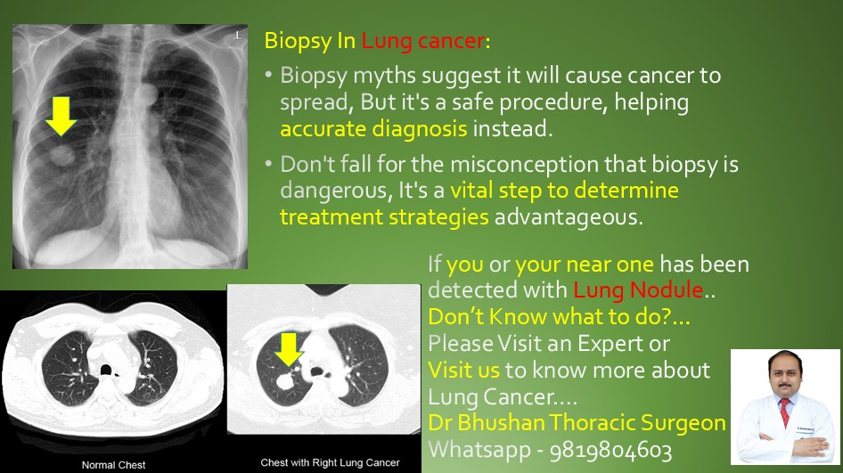 dr_thoracic's tweet photo. https://t.co/CTtqlWGmdt
