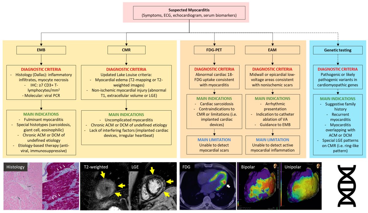 SRMyocarditis's tweet photo. From bedside to the bench, the role of myocardial inflammation (M-Infl) is emerging in the pathophysiology, phenotype, and treatment of traditionally genetic cardiomyopathies (DCM/ACM). Check our "hot off the press" review!
https://t.co/RyycCYdKf6 https://t.co/73jChcCz3Y