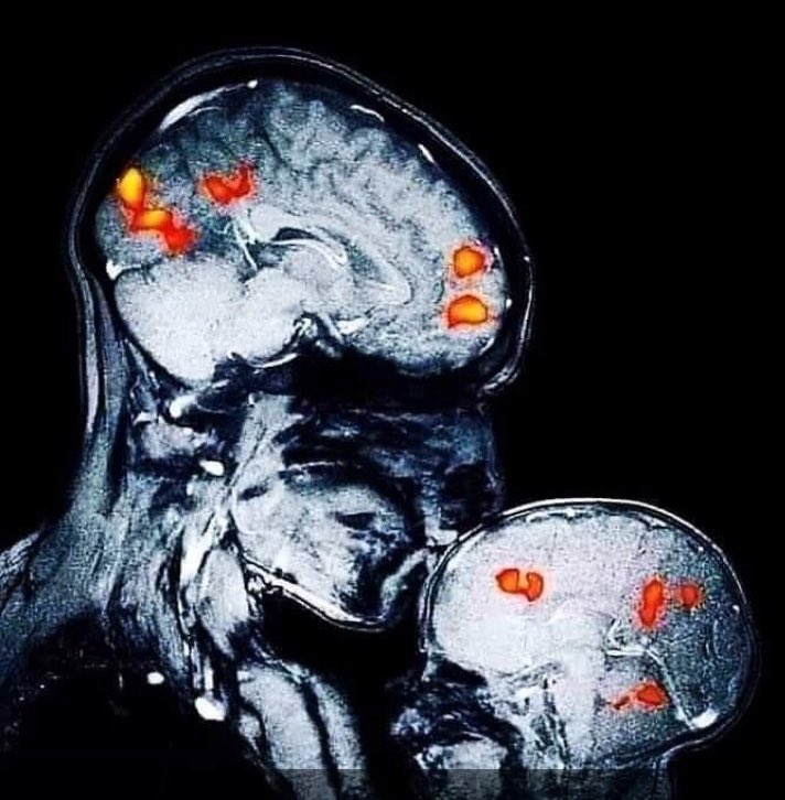 Temple Cardiothoracic Radiology (@templechestrads) on Twitter photo Happy Mother’s Day to all the amazing moms out there that have given us life. Thank you for all that you do, for all that you are. #MomsAreSuperheros  #MothersDay #RadiologyMoms Happy Mother’s Day to all the amazing moms out there that have given us life. Thank you for all that you do, for all that you are. #MomsAreSuperheros  #MothersDay #RadiologyMoms