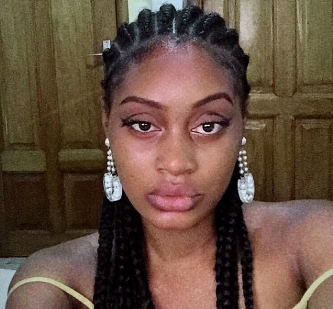 Chance (Traits de beautés sans chirurgie) tweet media