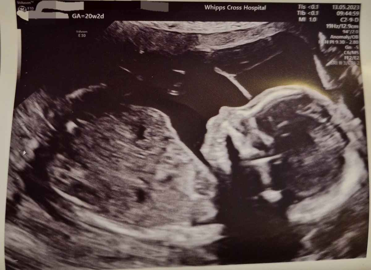 Rainy_artworks | Art commissions open! tweet media