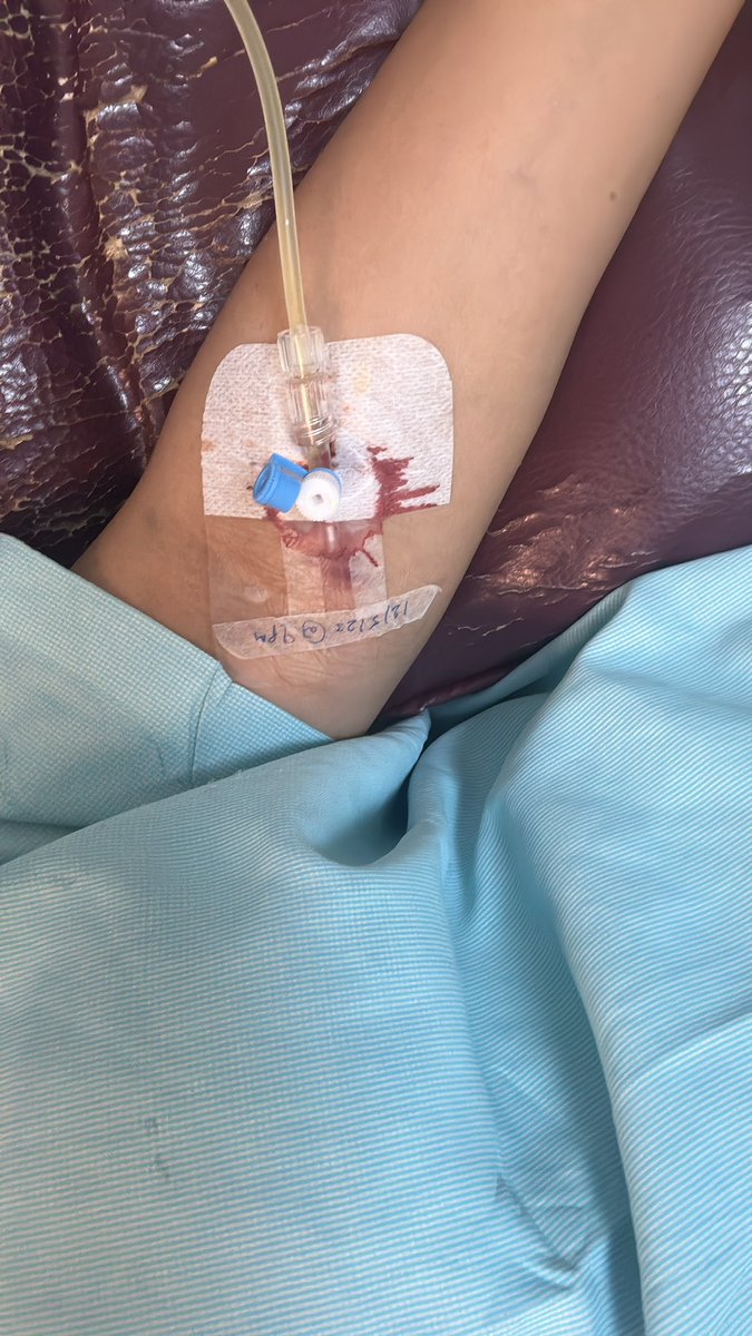 konpal's tweet photo. So after my last year’s episode of optic neuritis, I am yet again hospitalised and again having blurry vision. It’s been 4 days already and I am on steroids as of now. Today they are going to do my bone marrow test which have been once done in 2012 when it got diagnosed. #MS https://t.co/XAkBwhANlE