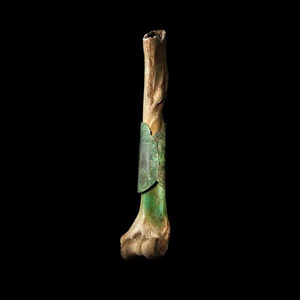 Rainmaker1973's tweet photo. Humerus Varnhemiensis is a humerus bone repaired by a copper-sheet cylinder from the late medieval time period, 1260-1527. Very likely, the plate was placed round the bone to stabilize a cut injury and the copper had an antibacterial effect on the wound: https://t.co/TxdbJ3Kh0Q https://t.co/FezdPhmLwj