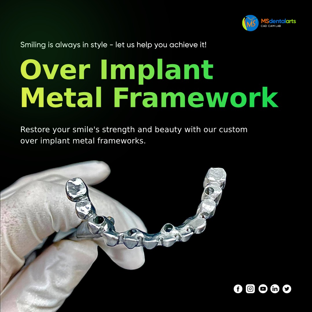 Msdentalarts's tweet image. Introducing the future of dental restorations! 🦷✨ Our advanced metal framework over implant technology at MS Dental Arts ensures superior strength, durability, and a stunning smile transformation. Discover the power of modern dentistry today! #MSDentalArts #MetalFramework