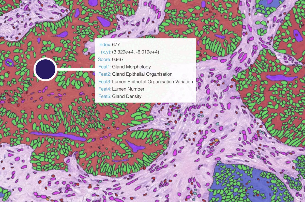 Simon Graham (@simongraham73) on Twitter photo Happy to announce the publication of IGUANA in <a href="/Gut_BMJ/">Gut Journal</a>, which introduces an #interpretable solution for #colon #biopsy screening- a significant step towards transparent #AI in #pathology 📢 . Learn more by checking out the paper at gut.bmj.com/content/early/….
@PathLake_CoE Happy to announce the publication of IGUANA in <a href="/Gut_BMJ/">Gut Journal</a>, which introduces an #interpretable solution for #colon #biopsy screening- a significant step towards transparent #AI in #pathology 📢 . Learn more by checking out the paper at gut.bmj.com/content/early/….
@PathLake_CoE