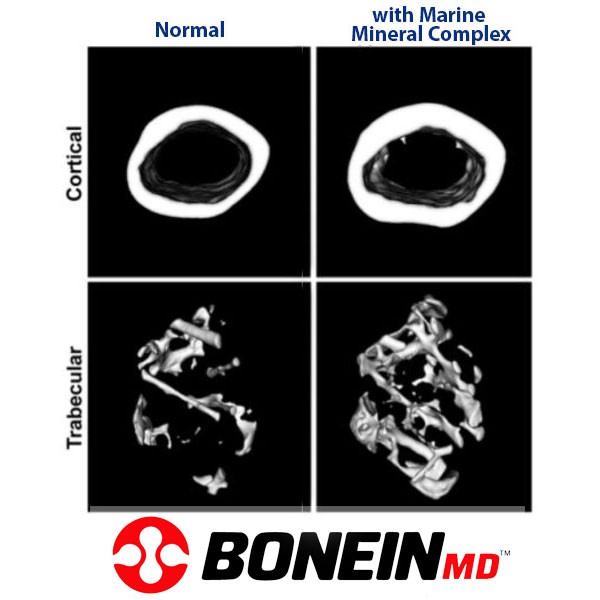 Osteogenusa's tweet photo. In fact, female mice receiving the mineral-rich supplement in the High Fat Western Diet had better bone structure/function than did female mice on the low-fat chow diet.
Read more π https://t.co/07eqGlkYKN
#bonehealth #osteogen #calcium #supplement #jointhealth https://t.co/2r7jAjjha7