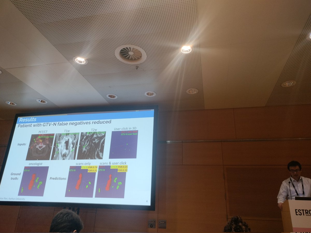 Yet another excellent presentation from our group - PhD student Jintao Ren shows how minimal user input can significantly improve detection rate in tumor auto-segmentation. #ESTRO23 @AUHdk @DCPTprotons