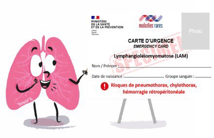 🚨 La carte d'#urgence pour les patientes atteintes de lymphangioléiomyomatose #LAM est disponible ✨
 🙏 <a href="/OrphaLung/">Vincent Cottin</a> et l’association de patients #FLAM !

#CCMR, #CRMR, si vous souhaitez en recevoir, contactez-nous !
➕d’info : bitly.ws/Ezmg