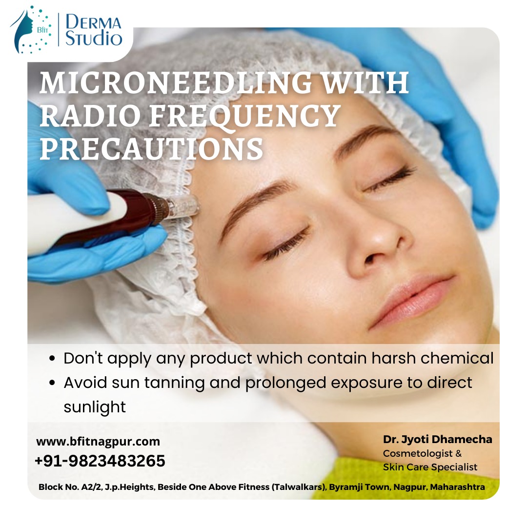 dermastudionag's tweet photo. MICRONEEDLING WITH RADIO FREQUENCY PRECAUTIONS!
• Don't apply any product which contains harsh chemicals.
• Avoid sun tanning and prolonged exposure to direct sunlight.
✅ 𝐖𝐞𝐛𝐬𝐢𝐭𝐞: https://t.co/fXXSIgIffT
#microneedling #collagenproduction #cosmeticprocedure https://t.co/dp1VuNf64m