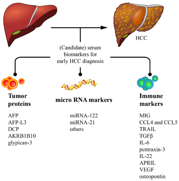 Cancers_MDPI's tweet photo. 🏆Check out the Editor's Choice #Review "Serum Biomarkers for the Prediction of Hepatocellular Carcinoma"

👥Authors: @JoseDebesMD, @pabloromagnoli et al. @ErasmusMC @IucbcI

🔗Link here: https://t.co/BDHi8vdZYI https://t.co/q6rN0WB9JT