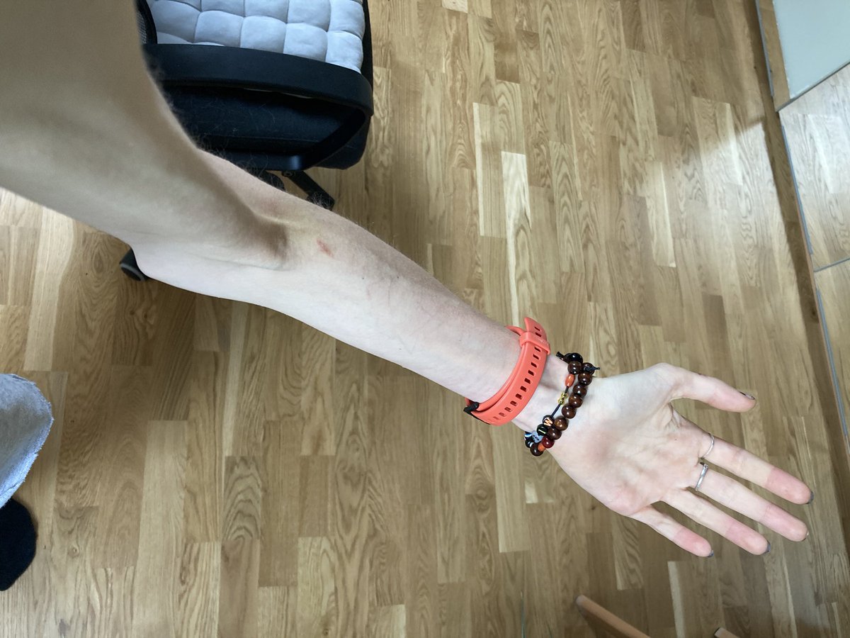 donttouchander's tweet photo. b0dychecks for edtwt🌟🌟
im back at the ed ward, i feel so disgusting and i hate everything, im just miserable
⟳ always appreciated<3
# bonesp0 thinsp0 th1nspo bc legsspo legsp0 deathsp0 sicksp0 abs fitsp0 https://t.co/9Op8sGo159