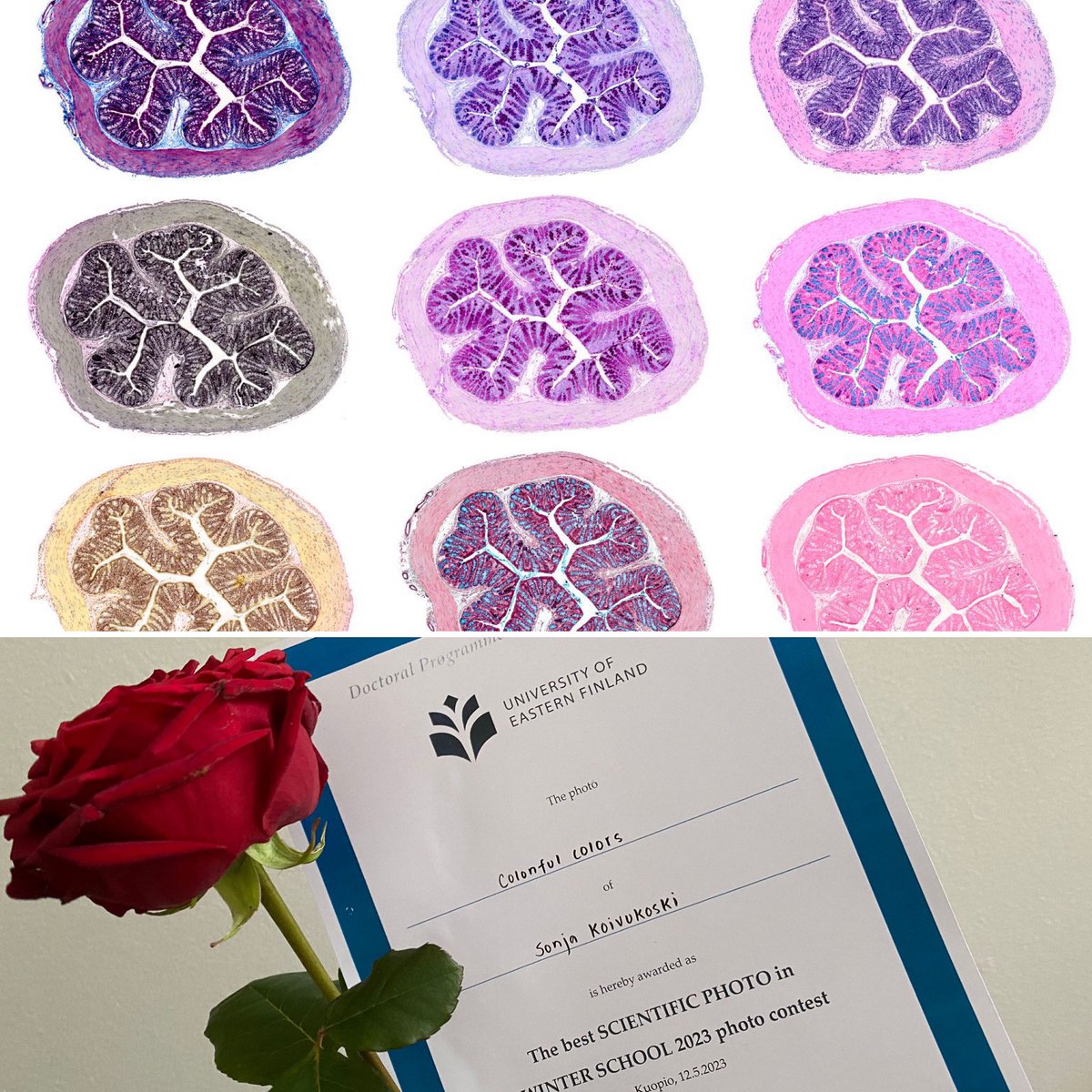 Leena Latonen (@latonenleena) on Twitter photo Congratulations to our grad student <a href="/SonjaKoivukoski/">Sonja Koivukoski</a> who won the <a href="/UEF_DPMM/">UEF Doctoral Programme in Molecular Medicine</a> Winter School photo contest with her beautiful #histology compilation ”Colonful colors”! <a href="/UEF_Biomed/">UEF Institute of Biomedicine</a> <a href="/UEFcancer/">UEFcancer</a> <a href="/UniEastFinland/">University of Eastern Finland</a> Congratulations to our grad student <a href="/SonjaKoivukoski/">Sonja Koivukoski</a> who won the <a href="/UEF_DPMM/">UEF Doctoral Programme in Molecular Medicine</a> Winter School photo contest with her beautiful #histology compilation ”Colonful colors”! <a href="/UEF_Biomed/">UEF Institute of Biomedicine</a> <a href="/UEFcancer/">UEFcancer</a> <a href="/UniEastFinland/">University of Eastern Finland</a>