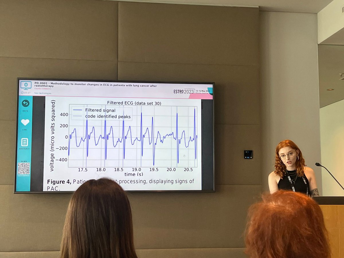 Manchester Cancer Research Centre (@mcrcnews) on Twitter photo Another huge well done to <a href="/CharlieCunniffe/">Charlie</a> on her first ever presentation at #ESTRO23 👏 
Her poster discussion covered ‘New technologies for treatment planning and dose verification’
🗣Methodology to monitor changes in ECG in patients with lung cancer after radiotherapy Another huge well done to <a href="/CharlieCunniffe/">Charlie</a> on her first ever presentation at #ESTRO23 👏 
Her poster discussion covered ‘New technologies for treatment planning and dose verification’
🗣Methodology to monitor changes in ECG in patients with lung cancer after radiotherapy