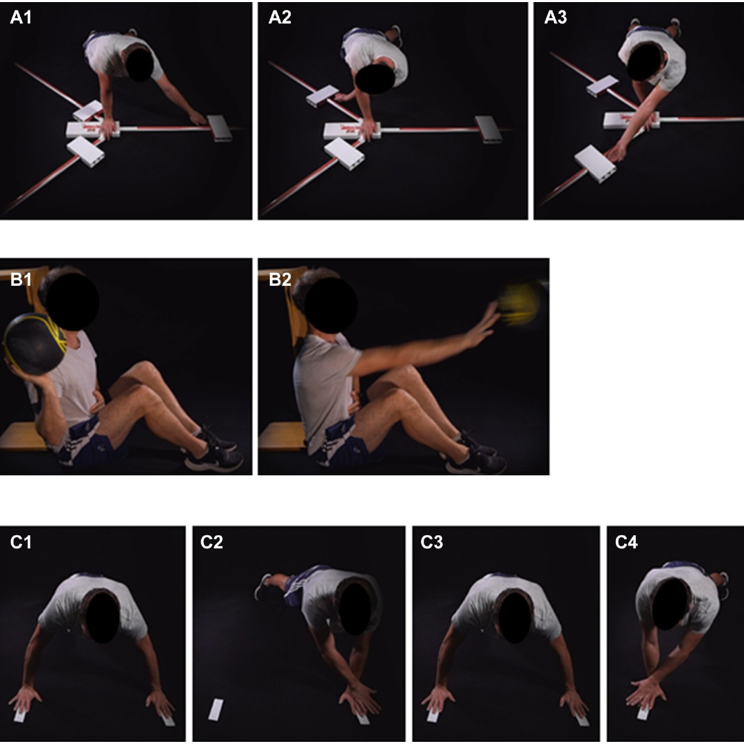 Effects of shoulder dominance in open #Latarjet procedure: Surgery in the dominant shoulder was associated with deficits in both shoulders, indicating healthy-side functional performance cannot be the only reference for a return-to-sport program   ow.ly/518r50OkJhL