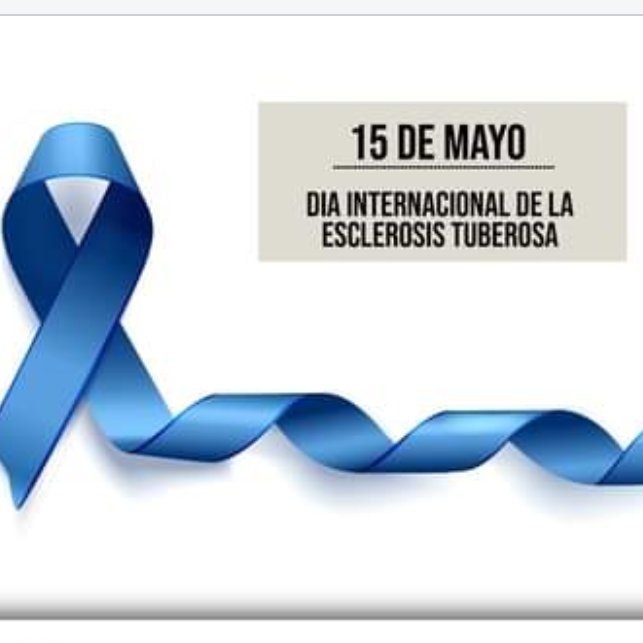 MPPSMiranda's tweet photo. #15May Día Internacional de la Esclerosis Tuberosa, oportuno para difundir más sobre esta #EnfermedadRara de origen genético, que genera tumores benignos en órganos vitales. Diagnóstico precoz, tratamiento eficaz y cirugía, brindan calidad de vida al paciente @guillenmarelia https://t.co/HtftfugKux