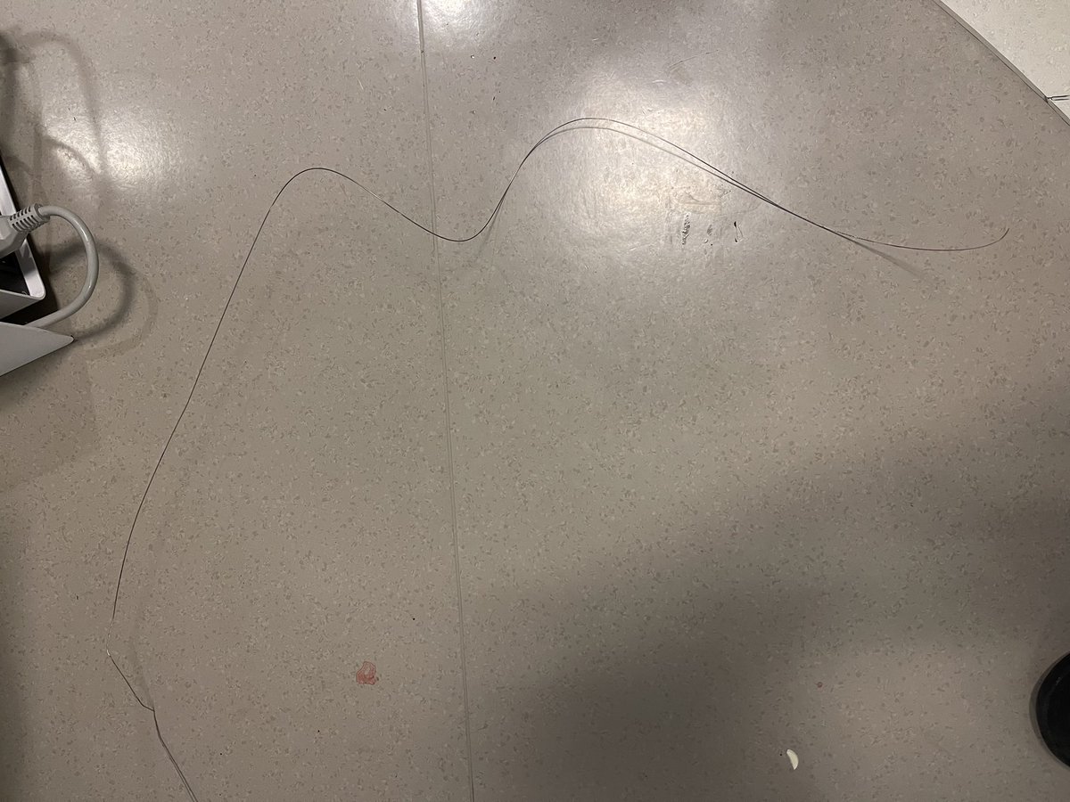 afallahi's tweet photo. @SripalBangalore @agtruesdell This was my case recently via femoral with a long 45cm sheath.  Extremely tortuous anatomy everywhere.  Do you think any benefit with larger long sheath 7 or 8f with these cases? https://t.co/Ah3rInnbz2