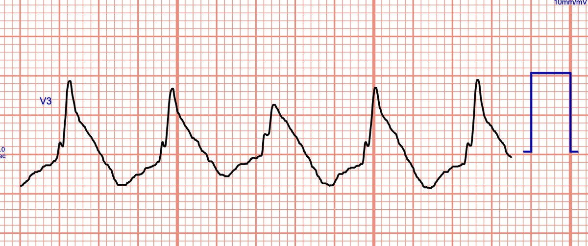 Andrew Sanchez M.D. on Twitter: 