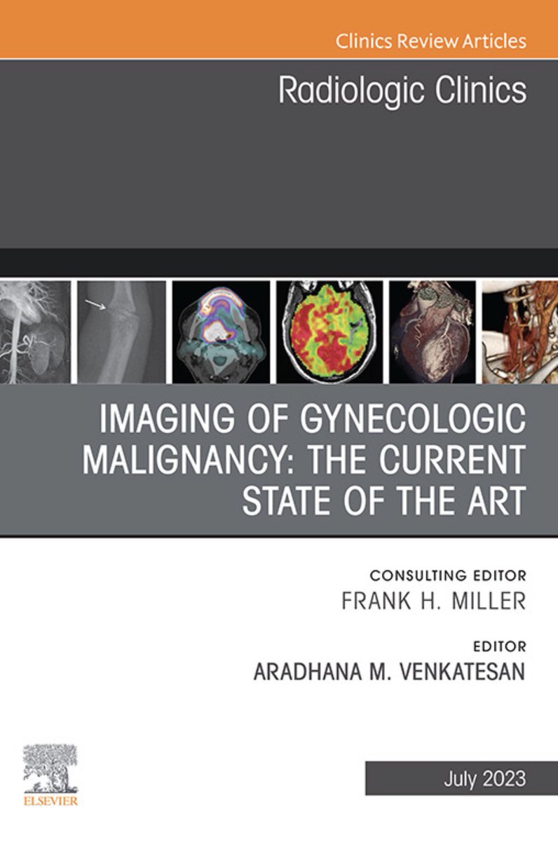 So pleased to announce that our @RadClinics Special Issue, #Imaging of #GynecologicMalignancy is now available online! Thank you to @RadClinics & all our expert authors for their invaluable contributions. @MDAndersonNews #EndCancer #Teamwork #Radiology bit.ly/42Xk5uV