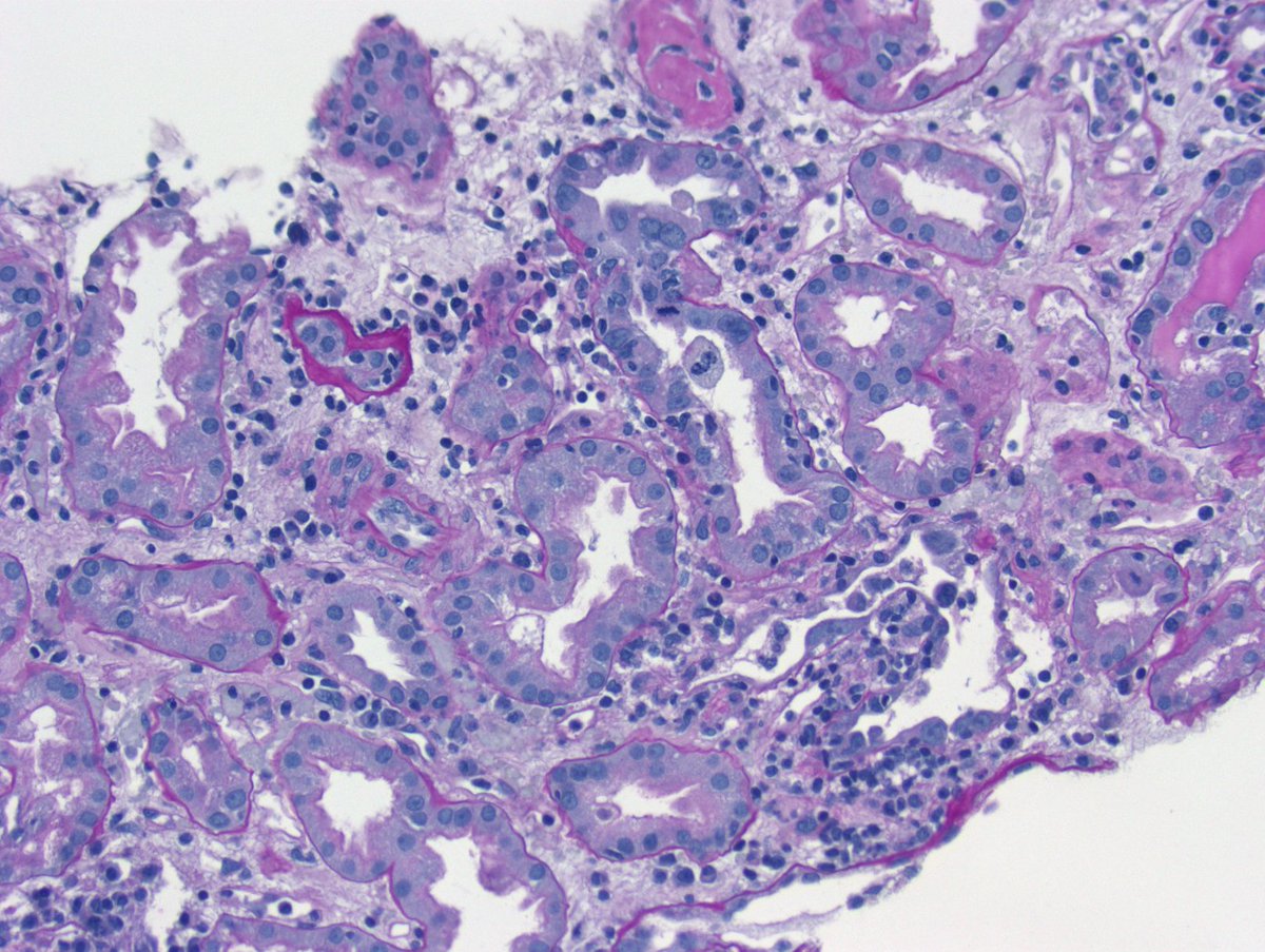 Kuang-Yu Jen, MD, PhD tweet media