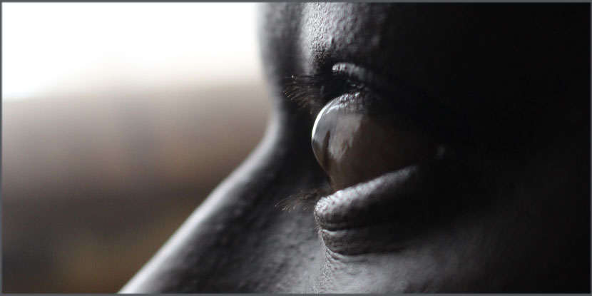 aao_ophth's tweet image. Repeating corneal #crosslinking a second time appears to be well tolerated and successful for treating progressive #keratoconus aao.org/education/edit… #cornea #refractivemanagement