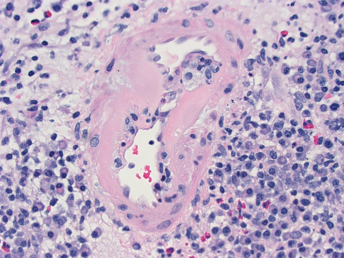 Kuang-Yu Jen, MD, PhD tweet media