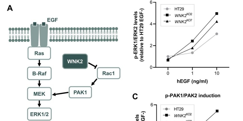 JMG (@jmg_bmj) on Twitter photo 👀 Previously "online first"
in press last week 📖
Germline mutations in WNK2 affect #MAPK pathway & may be associated with serrated #polyposis
OpenAccess: bit.ly/3MoaYhj
#Cancer #CancerGenetics <a href="/LValleResearch/">Laura Valle</a> <a href="/laiabonjoch/">Laia Bonjoch</a> <a href="/frankbalaguer/">Francesc Balaguer</a> <a href="/RMdeVoer/">Richarda de Voer</a> <a href="/mdiazgay/">Marcos Díaz-Gay</a> 👀 Previously "online first"
in press last week 📖
Germline mutations in WNK2 affect #MAPK pathway & may be associated with serrated #polyposis
OpenAccess: bit.ly/3MoaYhj
#Cancer #CancerGenetics <a href="/LValleResearch/">Laura Valle</a> <a href="/laiabonjoch/">Laia Bonjoch</a> <a href="/frankbalaguer/">Francesc Balaguer</a> <a href="/RMdeVoer/">Richarda de Voer</a> <a href="/mdiazgay/">Marcos Díaz-Gay</a>