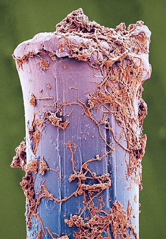 electron microscope image of a used toothbrush bristle
