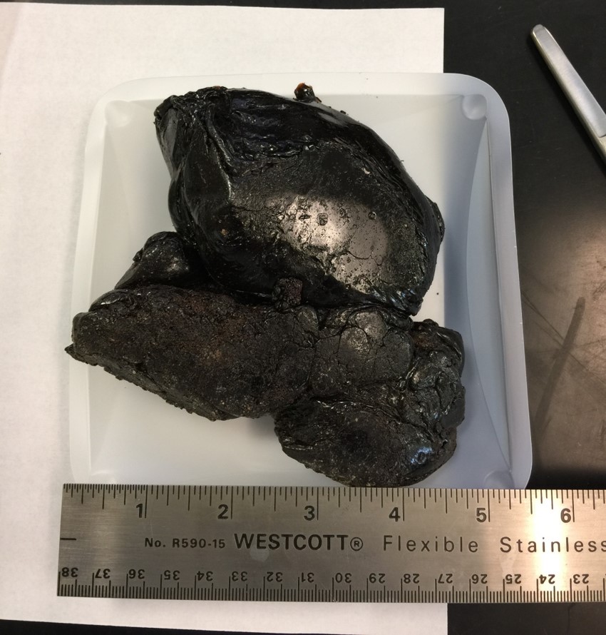 Infisnake's tweet photo. 1 ounce Black tar heroin giveaway

Rt
Follow 
Tag a homie you'd inject one with https://t.co/LPCmgRMwrx