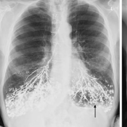 Interesting xray, but a sad situation.  Know what we are seeing?

Source: Internal and Emergency Medicine (2013).