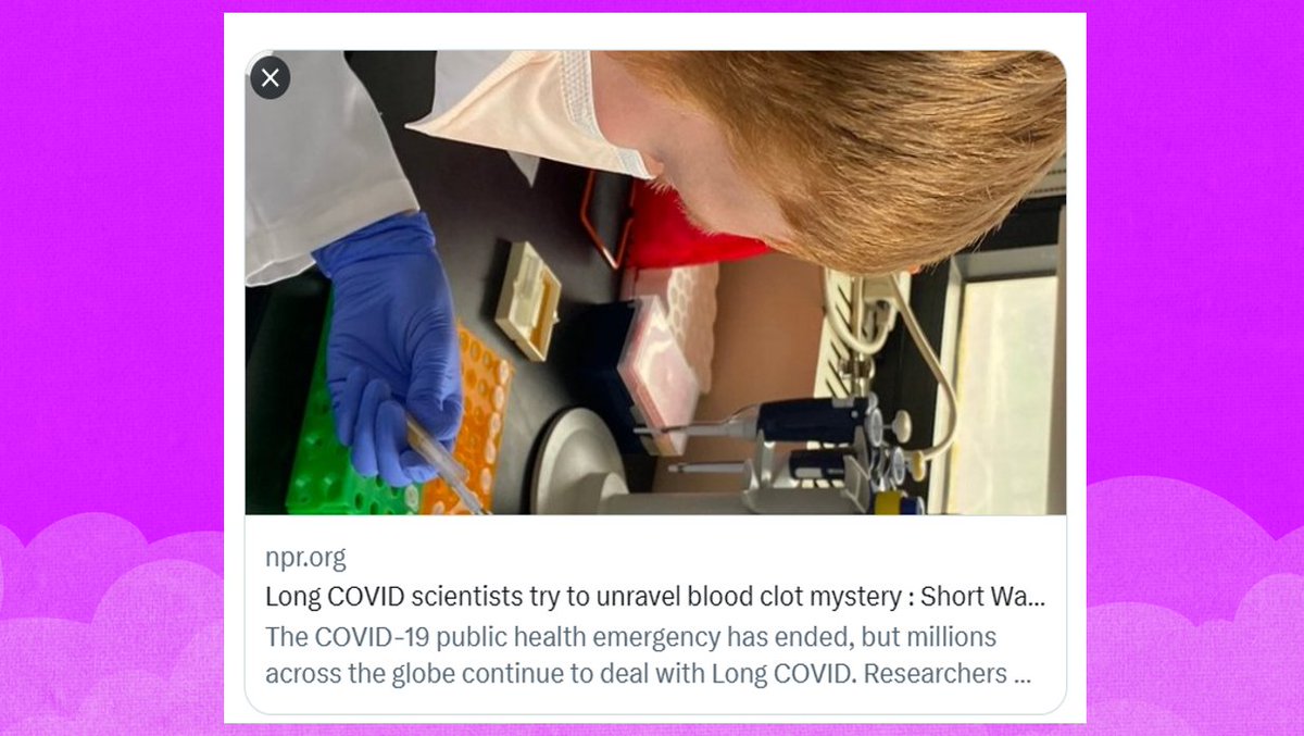 apresj20's tweet photo. Les caillots causés par le #CovidLong sont constitués de protéines uniques. 
Ils ne sont pas typiques des #MicroCaillots que nous voyons avec d'autres maladies
Ils sont constitués presque entièrement d'un type anormal de fibrine.. amyloïde"  Roy Silverstein, hématologue #ApresJ20 https://t.co/vGLPTDODzk