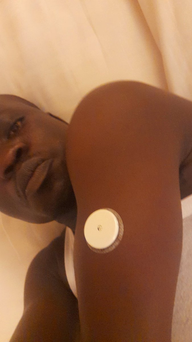 Embracing technology of Continues Glucose Monitoring (CGM) with my first Freestyle Libre 2 
#T1DAfrica, #T1DWarrior,